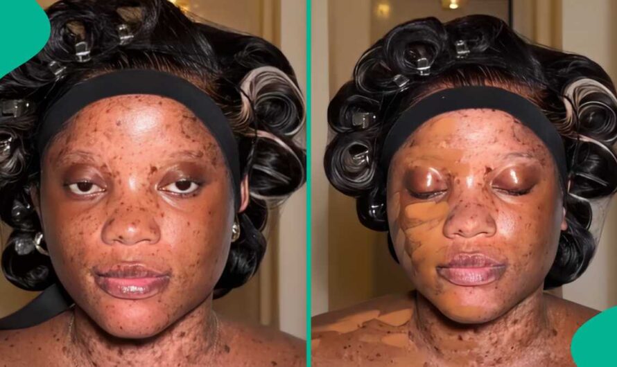 Lady Shows Amazing Makeup Transformation As Artiste Covers Her Freckles: “She Is Beautiful”